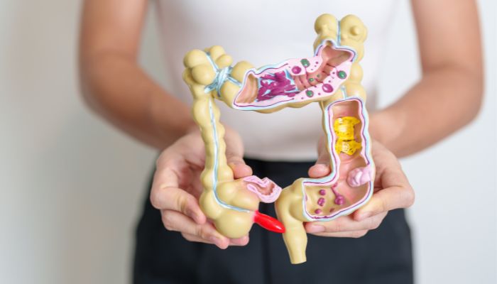 women holding demonstration tool of stomach 