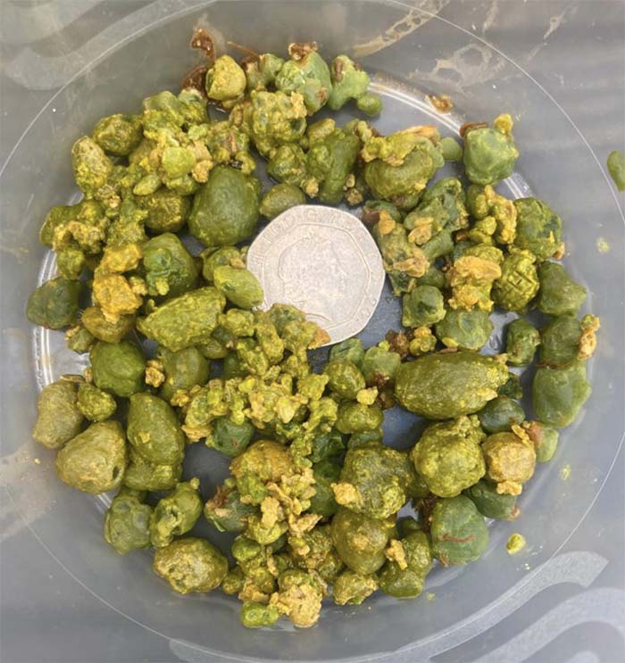 Green gallstones that have come out after a liver cleanse